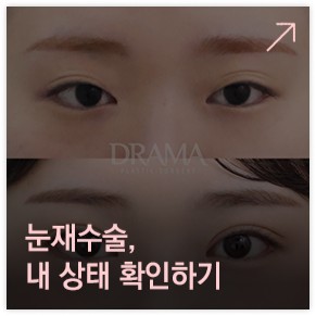 눈재수술 상태확인