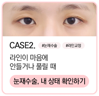 눈재수술 상태확인