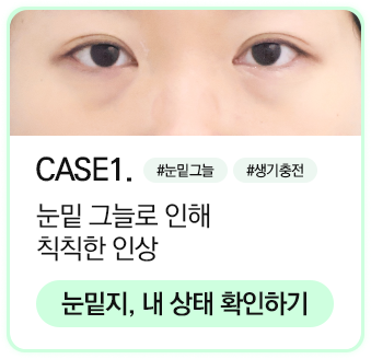 눈밑지 상태확인